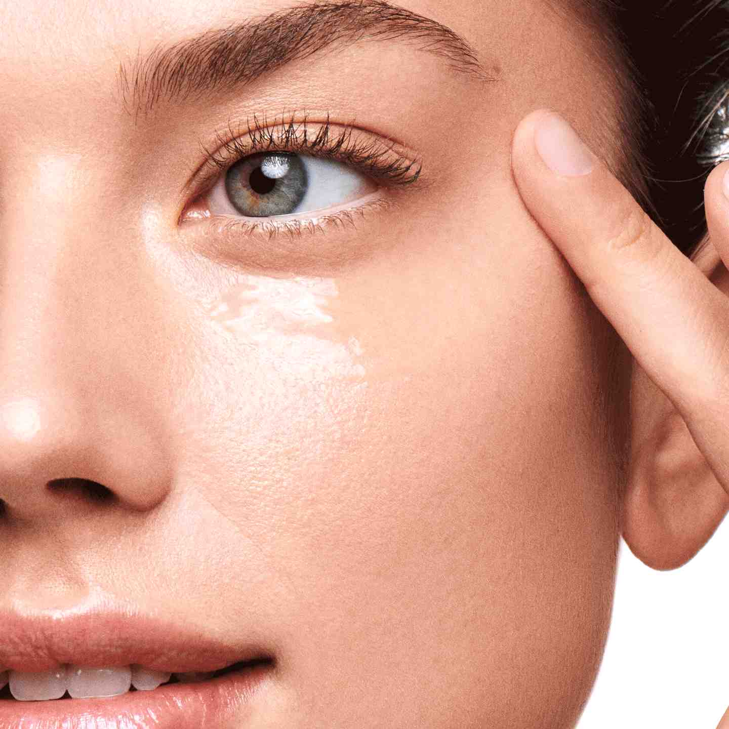 چگونه از شر تیرگی دور چشم خلاص شویم؟